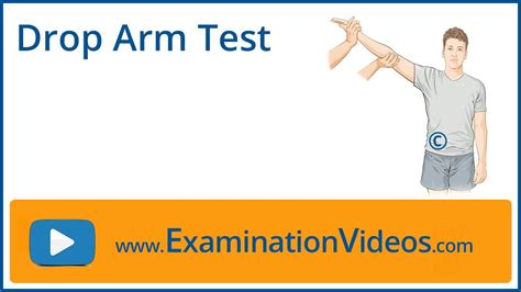 pseudoseizure hand drop test|drop arm test for psychogenic seizures.